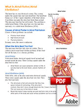 What is Atrial Flutter?